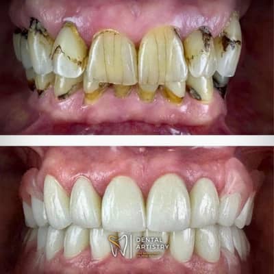 Slider image (1) Dental Artistry Dental Center